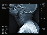 Fig.12 TAC del vocal tract di cantante sano