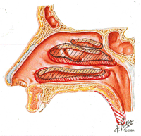 Sezione nasale con turbinati tratteggiati in scuro. Il tratteggio rosso segna l'ipertrofia dei turbinati. La coda del turbinato inferiore corrisponde 
all'apertura tubarica. Con la zona rinofaringea corrispondente si costituisce il distretto rinofaringotubarico