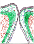 costituzione istologica del bordo glottico della corda vocale in salute e in sviluppo di lesione primitiva (reazione 
edematosa) e di nodulo